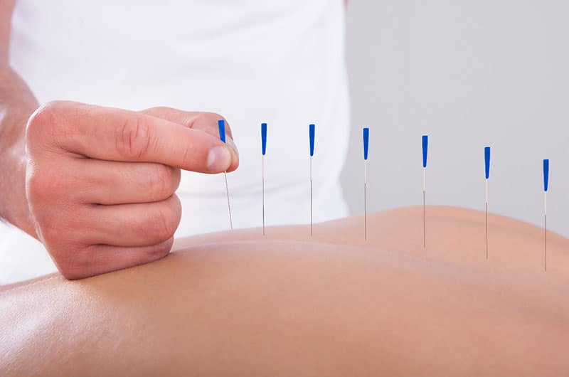 Why Nurses Shouldn’t Ignore The Potential Benefits Of Acupuncture
